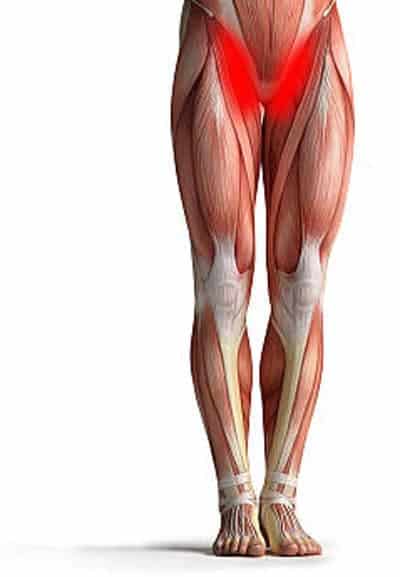 Pubalgia in soccer